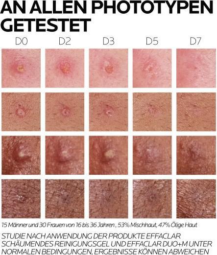 Valeurs nutritives et ingrédients La Roche Posay Effaclar Duo+M (40 ml, Crème 24h)