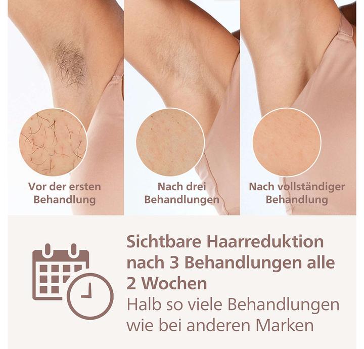 Actual product image Philips Lumea IPL Series 9000
