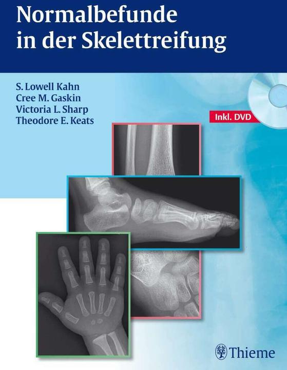 Actual product image Normalbefunde in der Skelettreifung (German, S. Lowell Kahn, Cree M. Gaskin, Victoria L. Sharp, Theodore E. Keats, 2012)