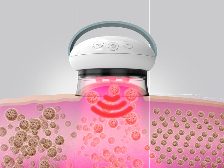 Actual product image Homedics Smoothee IR massager