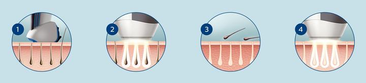 Produktbild Philips Lumea for Men