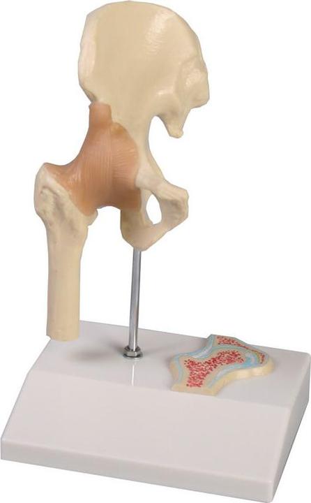 Actual product image Erler Zimmer Mini hip joint model with cross section