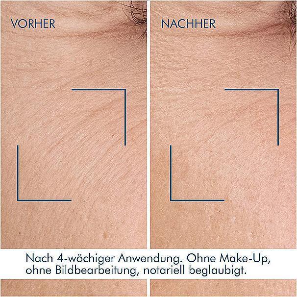 Immagine prodotto Biotherm Siero notte al retinolo blu (30 ml)