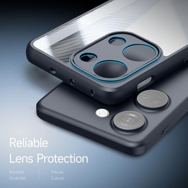 Actual product image Dux Ducis Aimo Series Hardcase (OnePlus North 3)