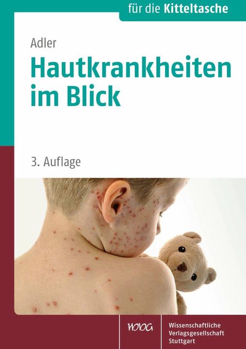 Actual product image Hautkrankheiten im Blick (German, Yael Eagle, 2015)