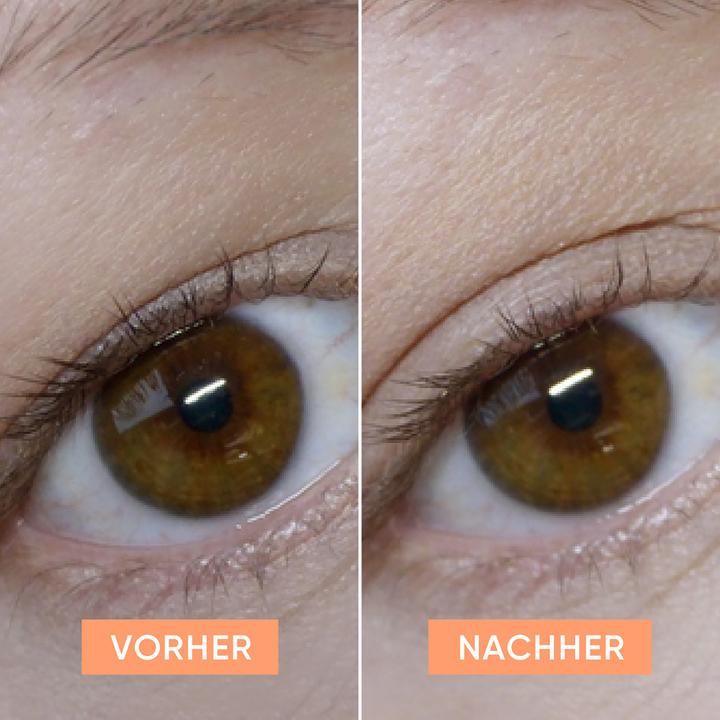 Actual product image Apricot Lifting Eyelid Tapes (Patches, Day)