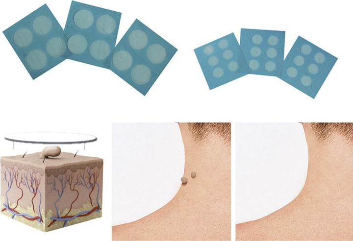 Image du produit Formu Clear Skin Tag Patch (Déodorants & poudre pour les pieds)