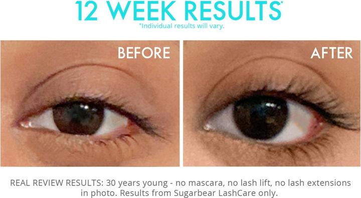 Produktbild Sugarbearhair - Lashcare Vitamin Serum (3 ml)