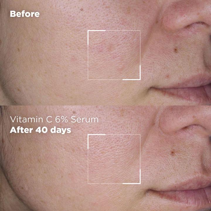 Immagine prodotto Skin Republic Vitamina C 6% (30 ml)