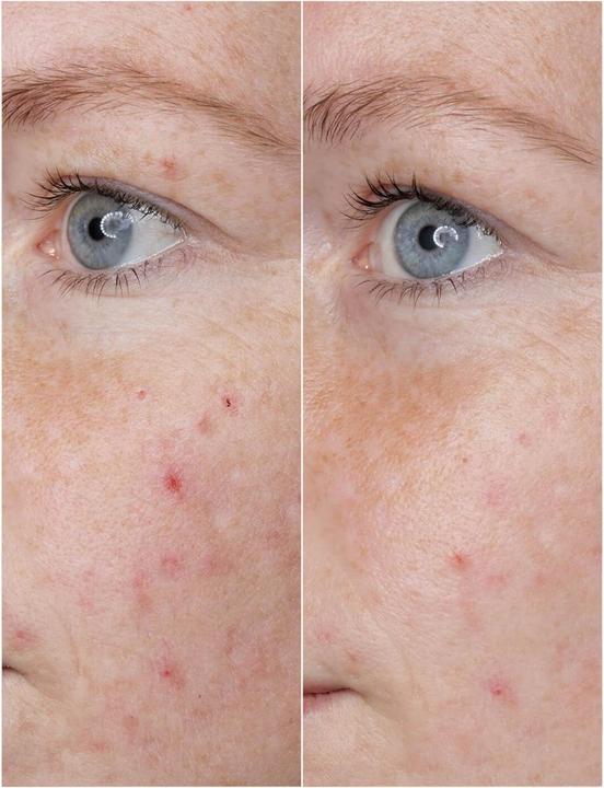 Actual product image Babor DOCTOR - Power Serum Ampoules Hyaluronic Acid (14 ml)