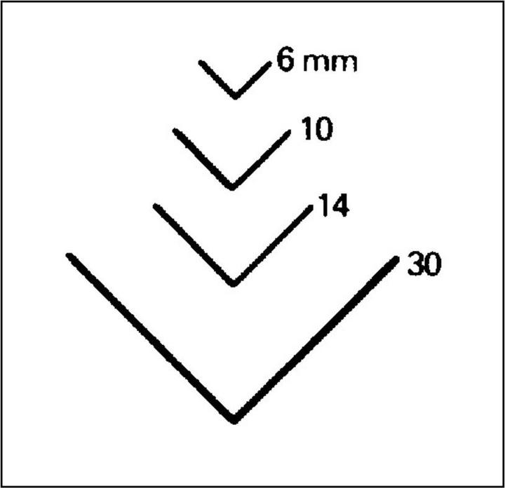 Produktbild Bildhauereisen gerade Form (1 mm)