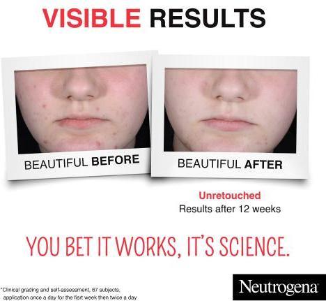 Produktbild Neutrogena Clear & Defend + Daily Serum (30 ml)