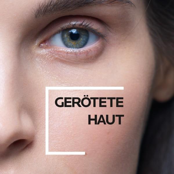 Image du produit La Roche Posay Toleriane Rosaliac AR concentré (40 ml, Crème 24h)