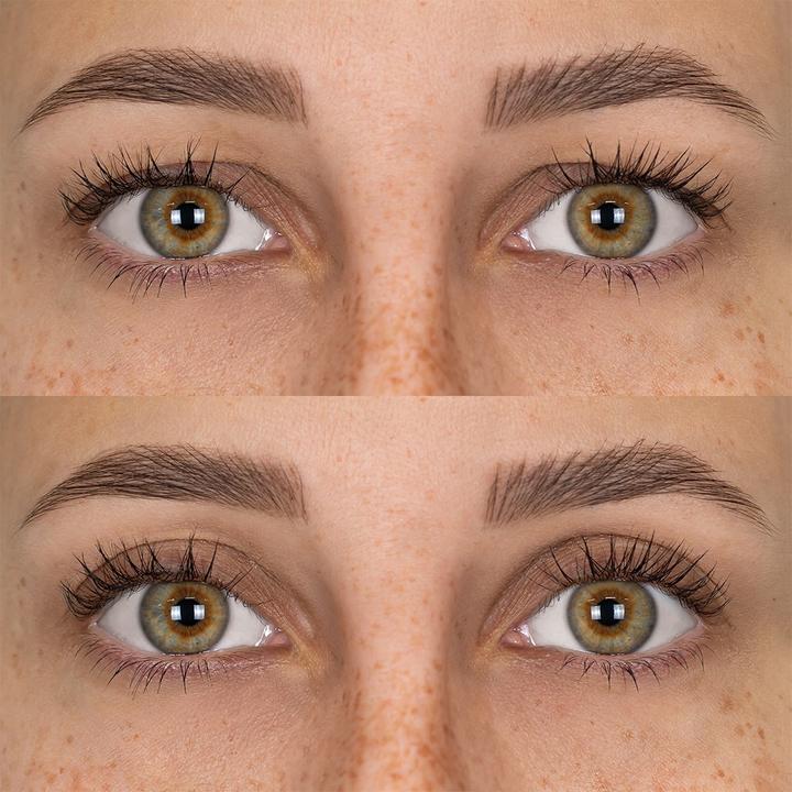 Actual product image Fleeky Magic Stripes stickers against drooping eyelids