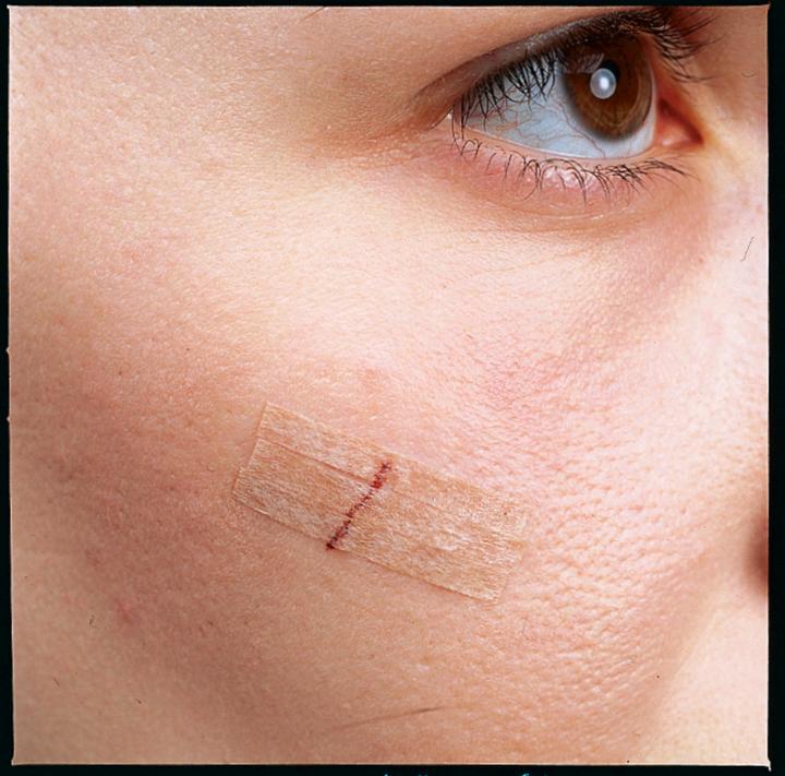Image du produit Nexcare Steri-Strip Bande de fermeture de plaie (6 x)