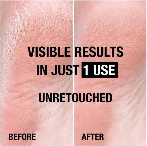 Image du produit Neutrogena Crème riche pour les pieds (Crème et gel pour les pieds, 100 ml)