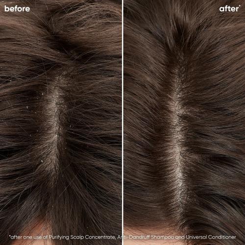 Immagine prodotto Matrix Shampoo antiforfora Biolage (250 ml, Shampoo liquido)