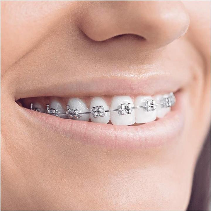 Actual product image Oral-B Teen (Oscillating toothbrush)