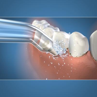 Produktbild Waterpik Classic Pik Pocket PP-70E (Mundduschenaufsätze)