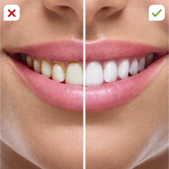 Actual product image MediaShop CorpCare Miracle Smile