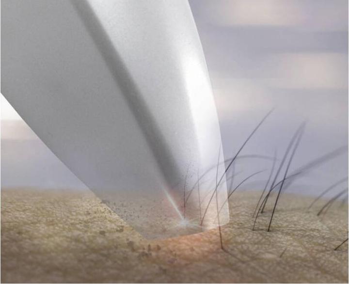 Actual product image Trisa Epilaser