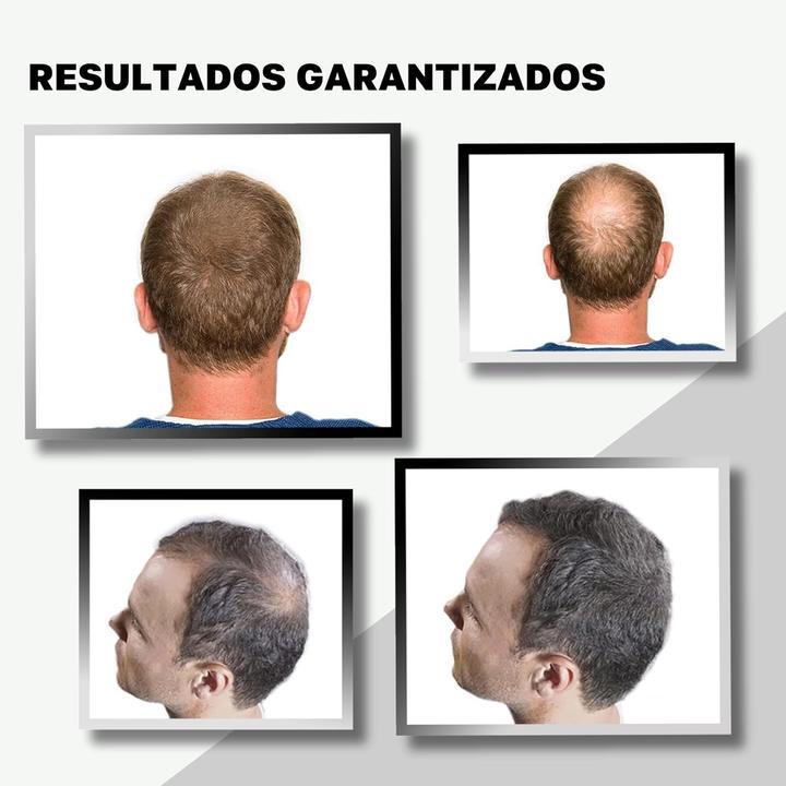 Produktbild Vidal Schütthaar Ansatzpuder zur Haarverdichtung (Dunkelbraun)