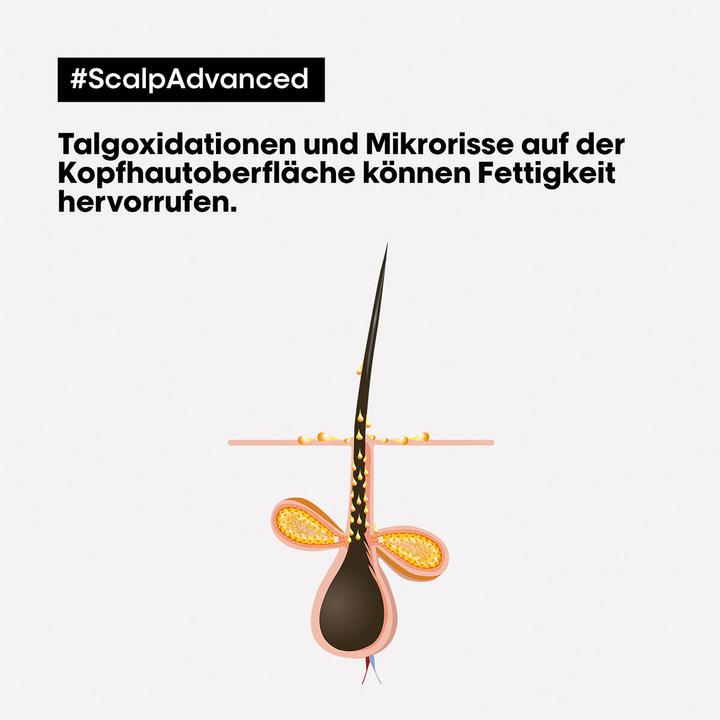 Actual product image L'Oréal Professionnel Scalp Advanced (250 ml)