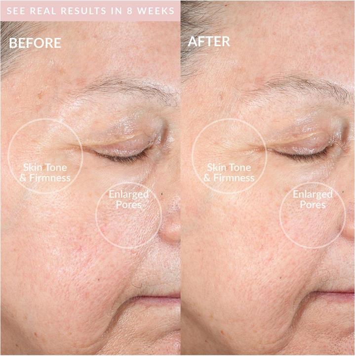 Produktbild PMD Clean Pro RQ Blush