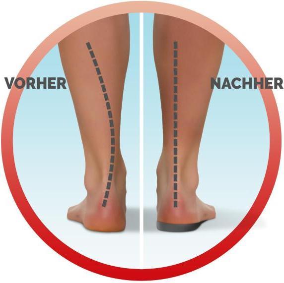 Immagine prodotto Scholl Solette In-Balance ¾ per il dolore dal ginocchio al tallone