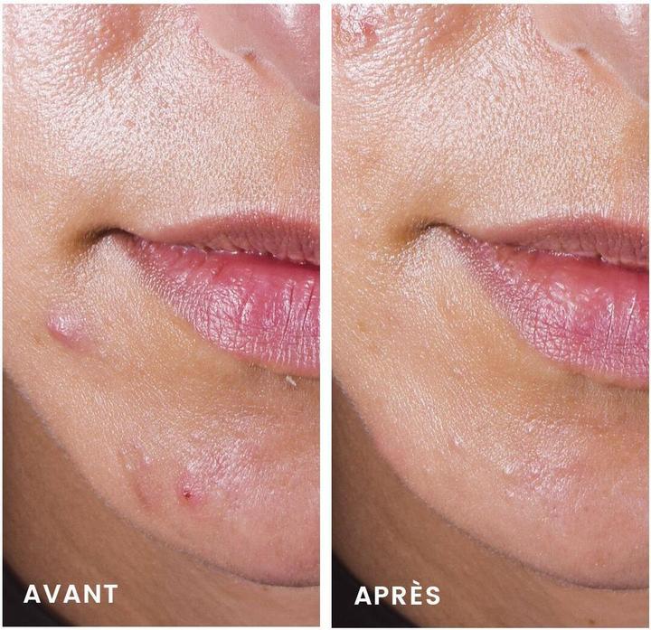 Image du produit Avène Concentré anti-imperfections Cleanance Comedomed (30 ml, Crème 24h)