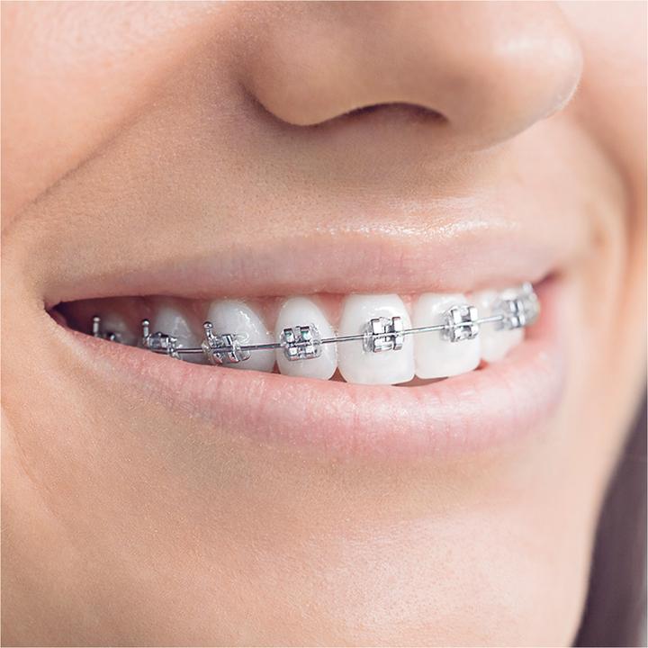 Image du produit Oral-B Kit de base pour les soins orthopédiques (3 x)