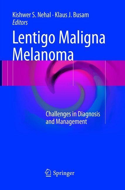 Actual product image Lentigo Maligna Melanoma (Klaus J. Busam, Kishwer S. Nehal, 2018)