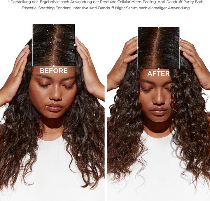 Actual product image Kérastase Symbiose Bain Pureté Anti-Pelliculaire (250 ml, Liquid shampoo)