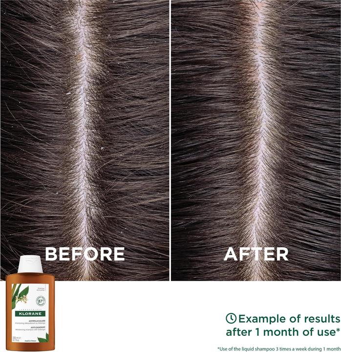Produktbild Klorane Anti-Schuppen Shampoo mit Galanga (400 ml, Flüssiges Shampoo)