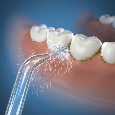 Image du produit Waterpik Wp60/70/90e (Embouts de douches buccales)