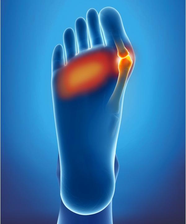 Produktbild Epitact Doppelschutzkissen Hallux Valgus und schmerzende Fusssohlen Gr. M (M)