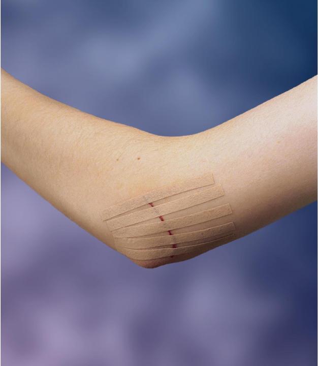Image du produit Nexcare Steri-Strip Bande de fermeture de plaie (6 x)