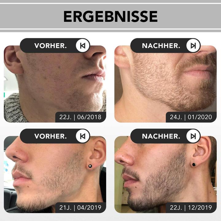 Immagine prodotto Anthony Brown Kit per la crescita della barba (75 ml)