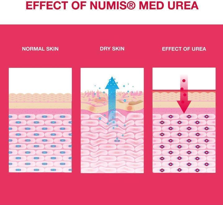 Produktbild Numis Med UREA 25% Schrundensalbe (Fusscrème & Fussgel, 50 ml)