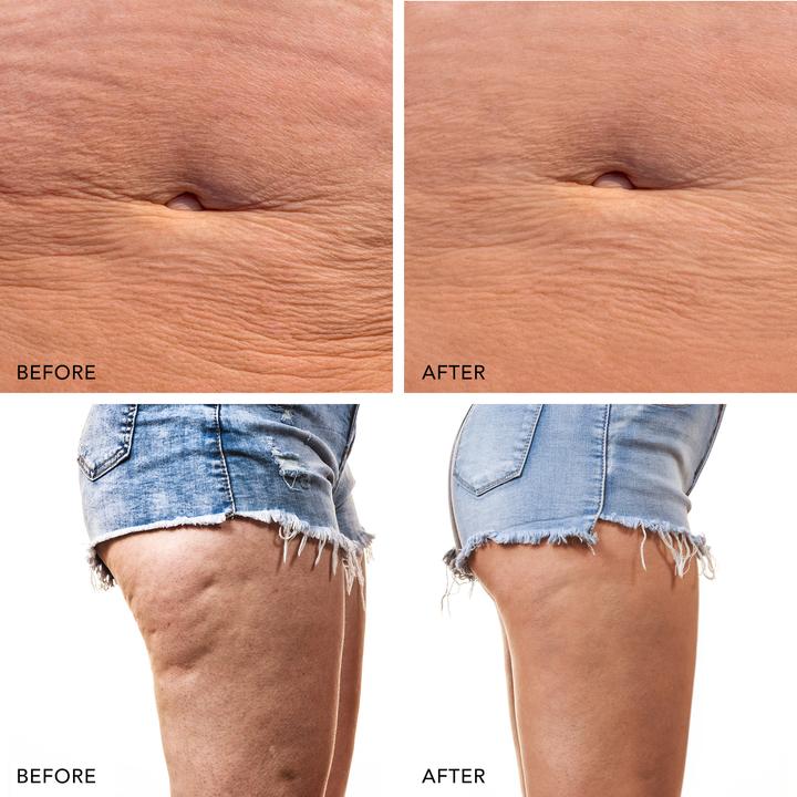 Produktbild Foreo Bear