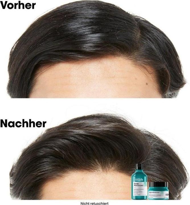 Actual product image L'Oréal Professionnel Scalp Advanced (250 ml)