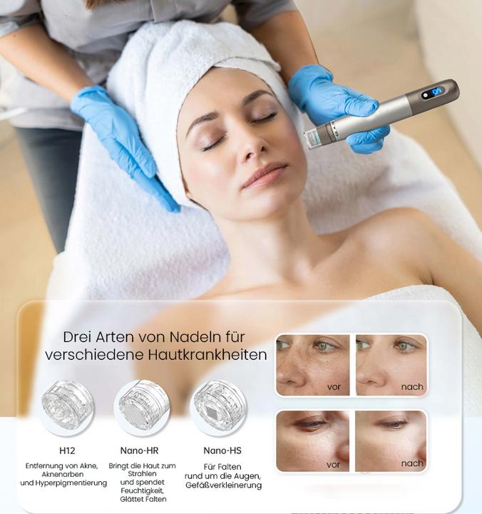 Immagine prodotto Beautifly SkinRenew Pro Dermapen