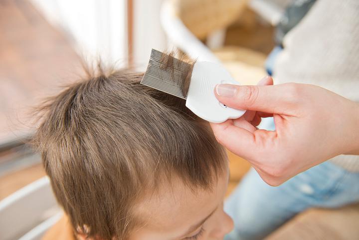 Produktbild Newgen medicals Läuse-, Nissen- & Flöhe-Kamm, 3,6 cm lange Metallzinken