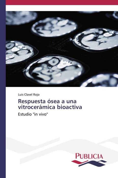Produktbild Respuesta ósea a una vitrocerámica bioactiva (Luis Clavel Rojo, 2014)