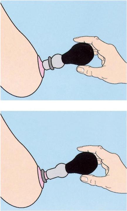 Actual product image You2Toys Clit Kiss