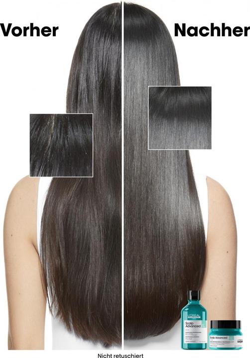 Actual product image L'Oréal Professionnel Scalp Advanced (250 ml)
