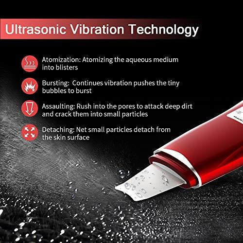 Produktbild Anlan Ultraschallpeelinggerät