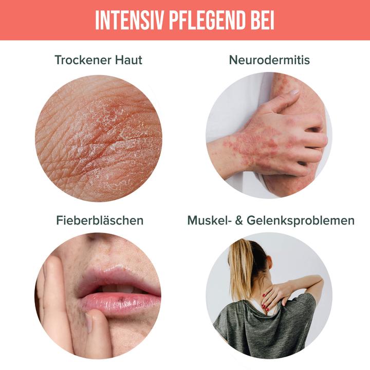 Immagine prodotto Hempions Balsamo riparatore al CBD (Crema corpo, 50 ml)