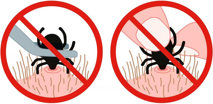 Produktbild TickSafe Zeckengreifer