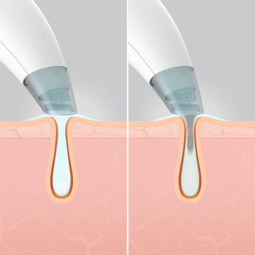 Produktbild Homedics Hydrafacial Cleanser